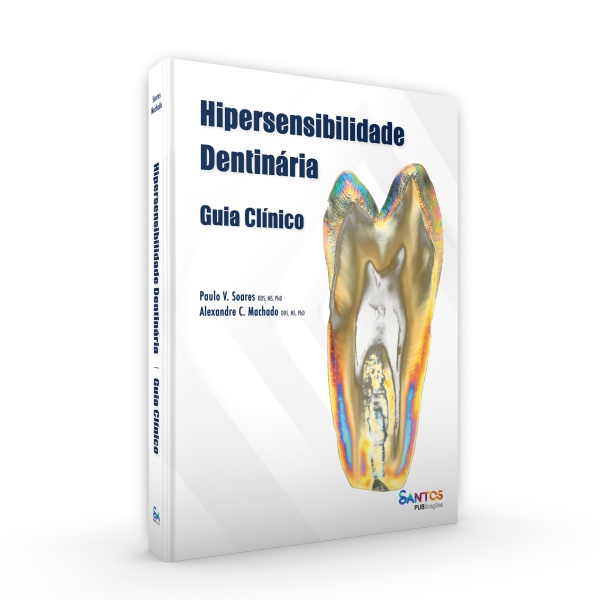 Hipersensibilidade Dentinária - Guia Clínico
