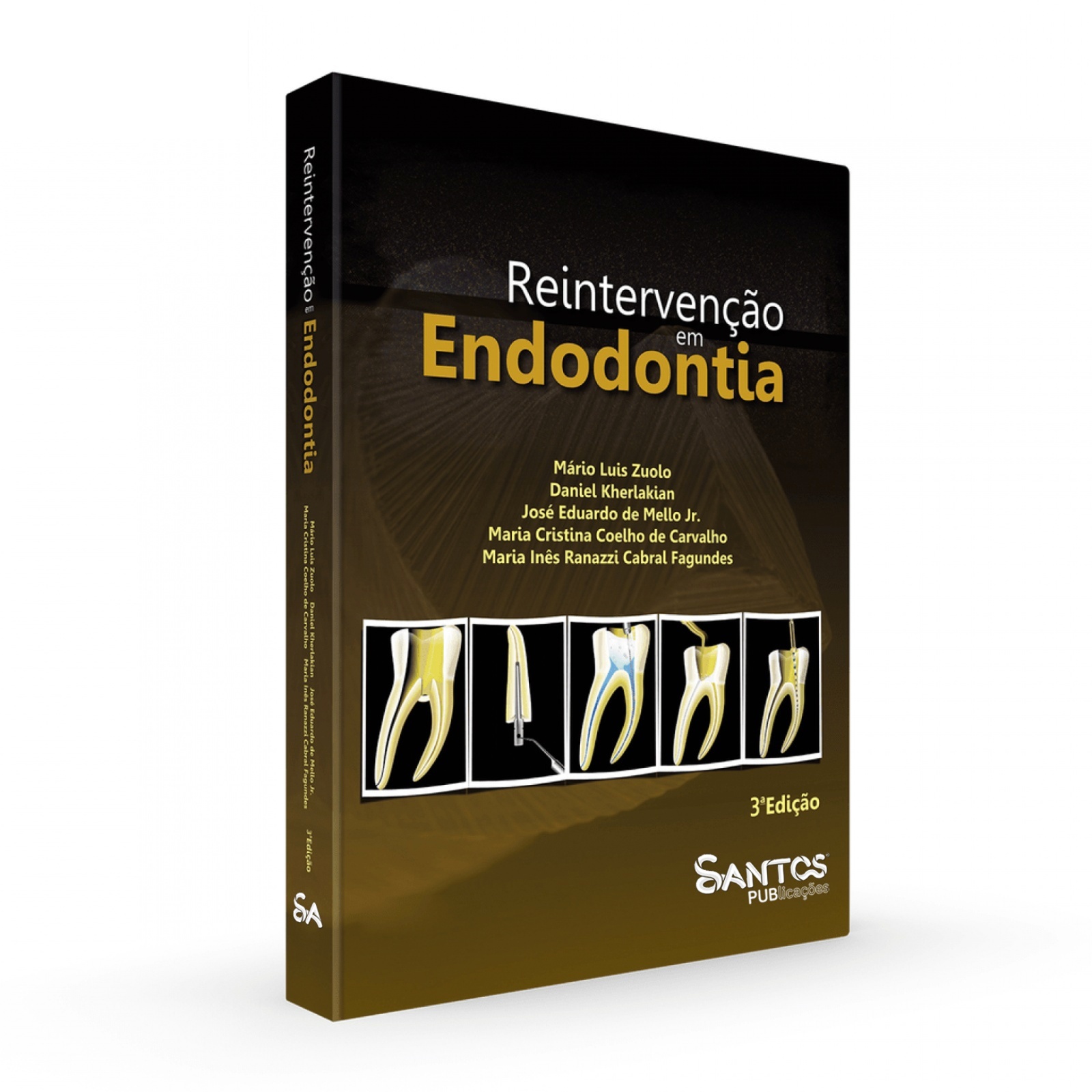 Reintervenção em Endodontia