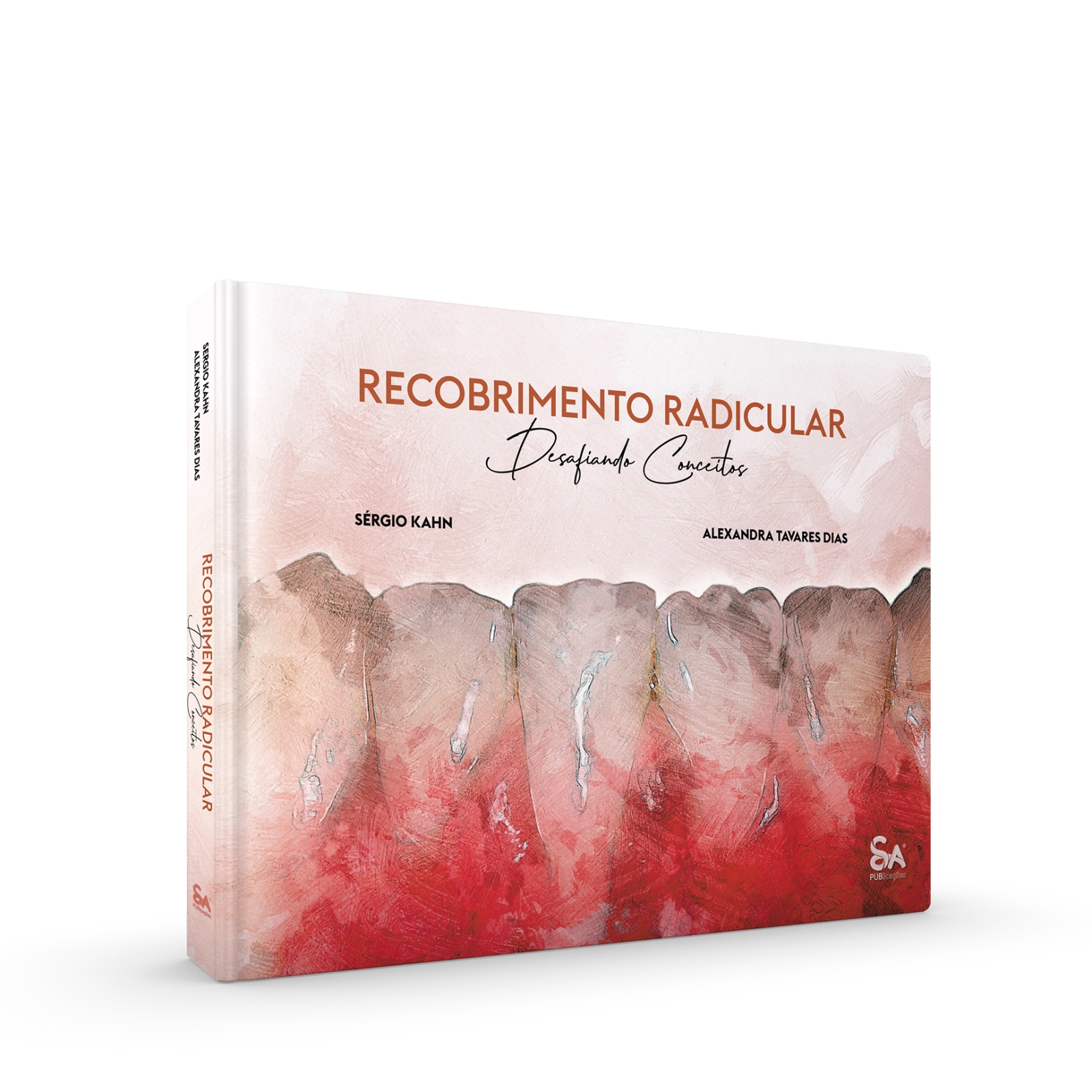 Recobrimento Radicular Desafiando Conceitos