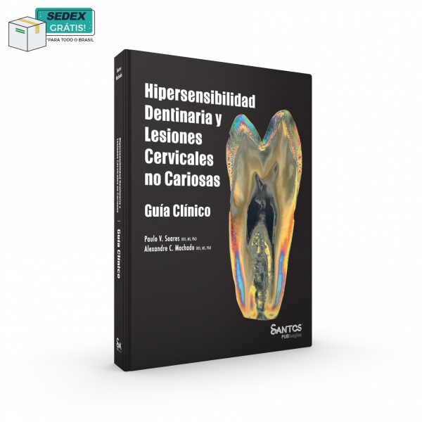 Hipersensibilidad Dentinaria y Lesiones Cervicales no Cariosas – Guía Clínico