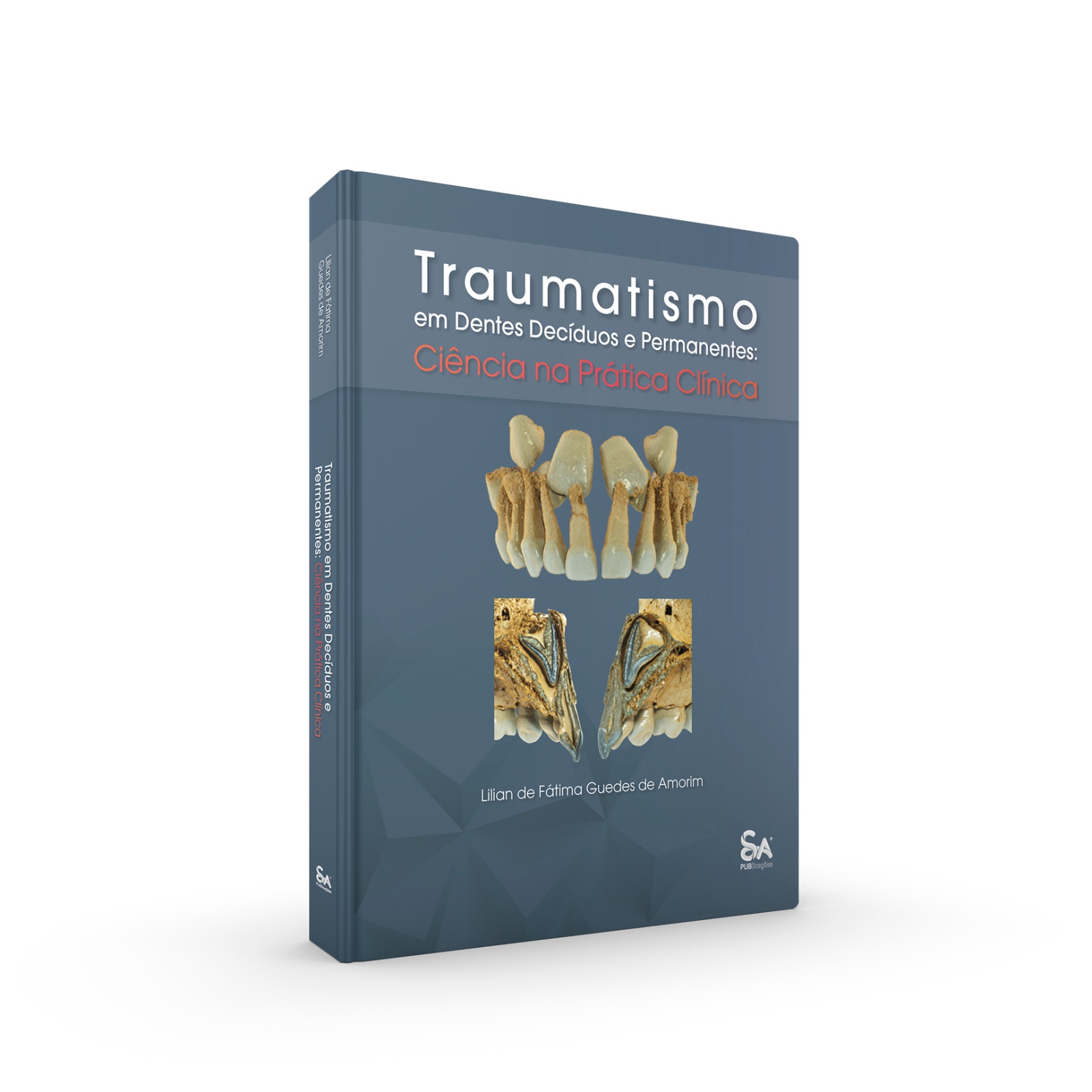 Traumatismo em Dentes Decíduos e Permanentes: Ciência na Prática Clínica