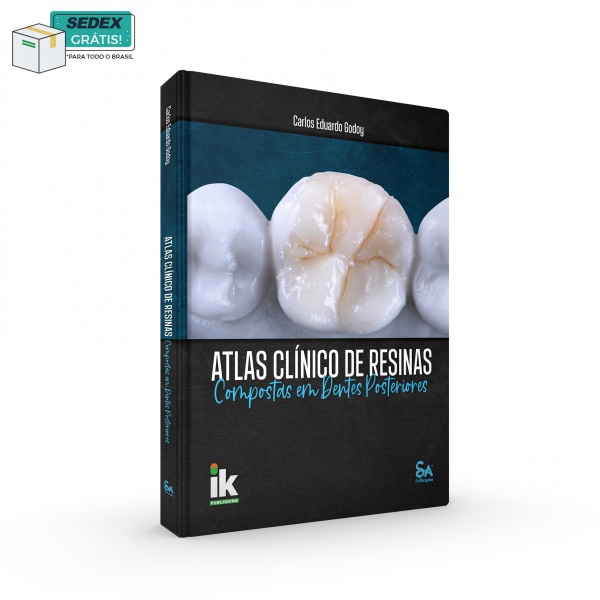 Atlas Clínico de Resinas Compostas em Dentes Posteriores