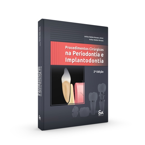 Procedimentos Cirúrgicos na Periodontia e Implantodontia