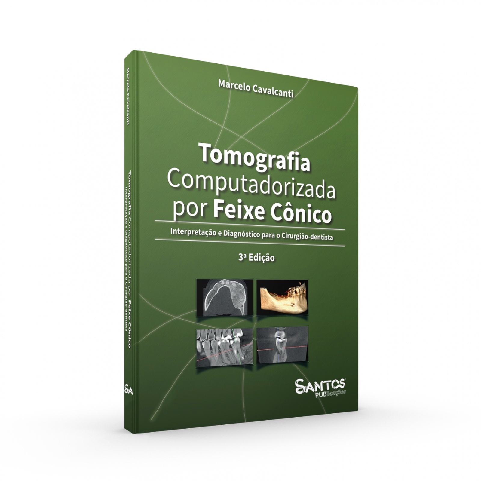 Tomografia Computadorizada Por Feixe Cônico