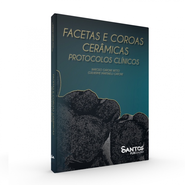 Facetas e Coroas Cerâmicas – Protocolos Clínicos